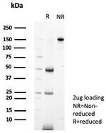 MIF (Macrophage Migration Inhibitory Factor) Antibody in SDS-PAGE (SDS-PAGE)