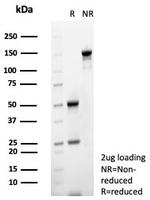MIF (Macrophage Migration Inhibitory Factor) Antibody in SDS-PAGE (SDS-PAGE)