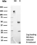 MIF (Macrophage Migration Inhibitory Factor) Antibody in SDS-PAGE (SDS-PAGE)