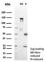 MIF (Macrophage Migration Inhibitory Factor) Antibody in SDS-PAGE (SDS-PAGE)