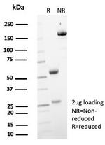 MIF (Macrophage Migration Inhibitory Factor) Antibody in SDS-PAGE (SDS-PAGE)