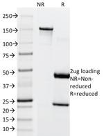 Microphthalmia Transcription Factor (MITF) Antibody in SDS-PAGE (SDS-PAGE)