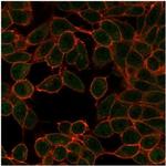 Microphthalmia Transcription Factor (MITF) Antibody in Immunocytochemistry (ICC/IF)