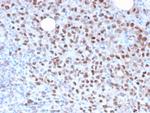 Microphthalmia Transcription Factor (MITF) Antibody in Immunohistochemistry (Paraffin) (IHC (P))