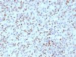 MLH1 (MutL Homolog 1) (Center)/HNPCC Antibody in Immunohistochemistry (Paraffin) (IHC (P))
