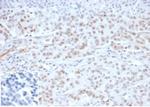 MLH1 (MutL Homolog 1)/HNPCC Antibody in Immunohistochemistry (Paraffin) (IHC (P))