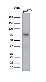 MLH1 (MutL Homolog 1)/HNPCC Antibody in Western Blot (WB)