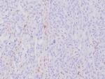 MLH1 (MutL Homolog 1)/HNPCC Antibody in Immunohistochemistry (Paraffin) (IHC (P))