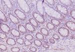 MLH1 (MutL Homolog 1)/HNPCC Antibody in Immunohistochemistry (Paraffin) (IHC (P))