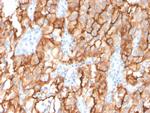 CD10 (Membrane Metalloendopeptidase) Antibody in Immunohistochemistry (Paraffin) (IHC (P))