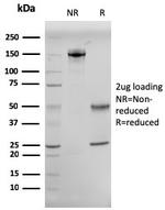 CD10 (Membrane Metalloendopeptidase) Antibody in SDS-PAGE (SDS-PAGE)