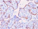 MMP3 Antibody in Immunohistochemistry (Paraffin) (IHC (P))