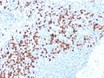 MMP9 (Matrix Metalloproteinase 9) Antibody in Immunohistochemistry (Paraffin) (IHC (P))