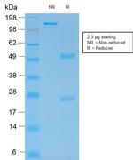 MMP9 (Matrix Metalloproteinase 9) Antibody in SDS-PAGE (SDS-PAGE)