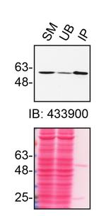 RXRA Antibody in Immunoprecipitation (IP)