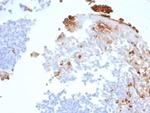 Myeloperoxidase/MPO Antibody in Immunohistochemistry (Paraffin) (IHC (P))