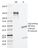 MRP1/ABCC1 (Multidrug Resistance Related Protein 1) Antibody in SDS-PAGE (SDS-PAGE)