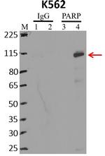 PARP1 Antibody in RNA Immunoprecipitation (RIP)