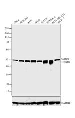 SMAD2 Antibody in Western Blot (WB)