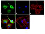 Galectin 1 Antibody in Immunocytochemistry (ICC/IF)