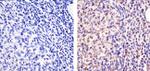 Galectin 1 Antibody in Immunohistochemistry (Paraffin) (IHC (P))