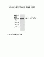 CYLD Antibody in Western Blot (WB)