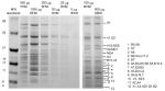 Complex I Antibody in Immunoprecipitation (IP)