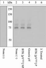 Phospho-Btk (Tyr551) Antibody in Western Blot (WB)