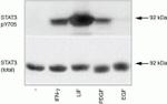 Phospho-STAT3 (Tyr705) Antibody