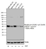 Phospho-ERK1/ERK2 (Thr185, Tyr187) Antibody in Western Blot (WB)