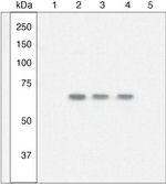 Phospho-NFkB p65 (Ser529) Antibody in Western Blot (WB)