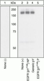 Phospho-EGFR (Tyr1148) Antibody in Western Blot (WB)