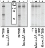 Phospho-VEGF Receptor 2 (Tyr1054, Tyr1059) Antibody in Western Blot (WB)