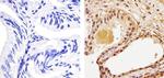 Phospho-PTEN (Thr383) Antibody in Immunohistochemistry (Paraffin) (IHC (P))