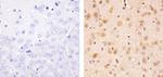 Phospho-PTEN (Thr383) Antibody in Immunohistochemistry (Paraffin) (IHC (P))