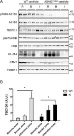 Phospho-AS160 (Thr642) Antibody in Western Blot (WB)