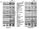 Phospho-Vinculin (Tyr100) Antibody in Western Blot (WB)