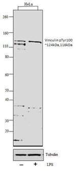 Phospho-Vinculin (Tyr100) Antibody in Western Blot (WB)