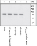 Phospho-LIMK1 (Tyr507, Thr508) Antibody in Western Blot (WB)