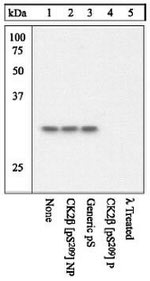 Phospho-CK2 beta (Ser209) Antibody in Western Blot (WB)