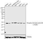 Phospho-CK2 beta (Ser209) Antibody in Western Blot (WB)