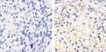 Phospho-FGFR1 (Tyr653, Tyr654) Antibody in Immunohistochemistry (Paraffin) (IHC (P))