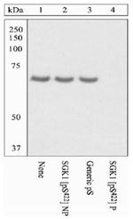 Phospho-SGK1 (Ser422) Antibody in Western Blot (WB)