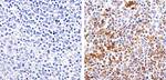 Phospho-Btk (Tyr551) Antibody in Immunohistochemistry (Paraffin) (IHC (P))