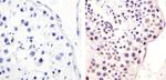 Phospho-MDM2 (Ser166) Antibody in Immunohistochemistry (Paraffin) (IHC (P))