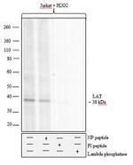 Phospho-LAT (Tyr191) Antibody in Western Blot (WB)