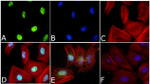 Phospho-SMAD2 (Ser465, Ser467) Antibody in Immunocytochemistry (ICC/IF)