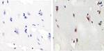 Phospho-SMAD2 (Ser465, Ser467) Antibody in Immunohistochemistry (Paraffin) (IHC (P))