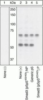 Phospho-SMAD3 (Ser423, Ser425) Antibody in Western Blot (WB)