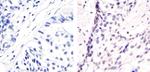 Phospho-ATF2 (Thr71) Antibody in Immunohistochemistry (Paraffin) (IHC (P))